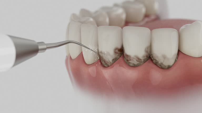 Reliable Dental contractor in Crest, CA by Smile Center Dentistry